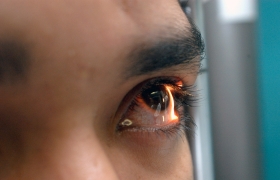 Alerta IMSS sobre síndrome ocular 